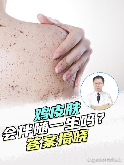 鸡皮肤有富贵命吗,什么体相的男人大富大贵