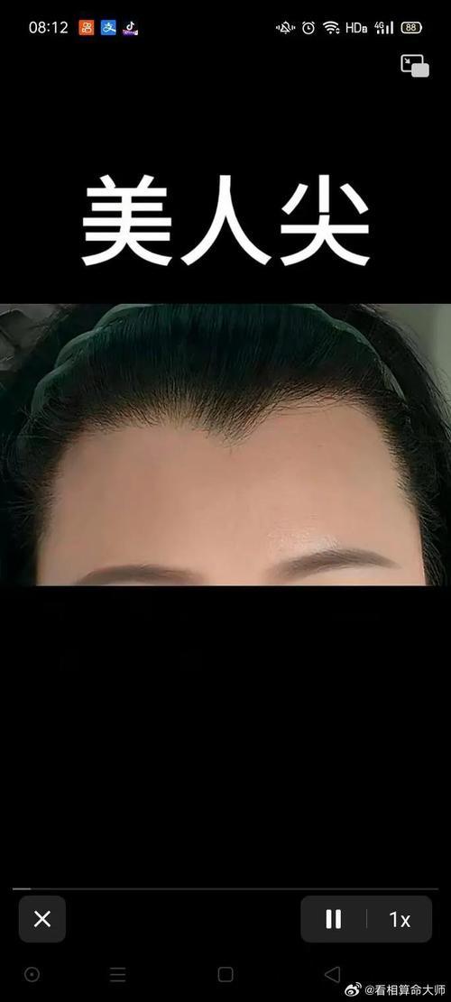 美人尖是富贵命吗,美人尖的人性格和命运是怎么样?