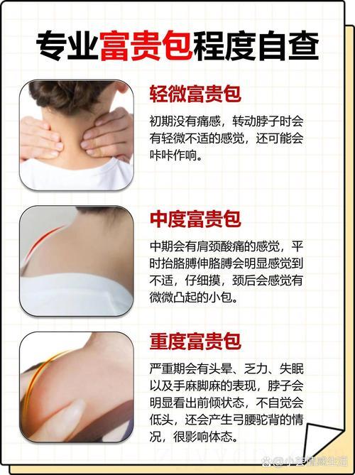 富贵包和富贵命的区别,什么是富贵包?
