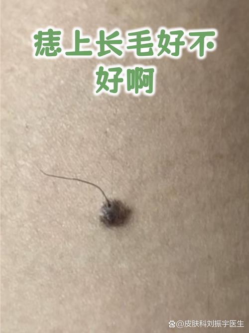 这地方长毛的人多是富贵命,贫贵富贱看面相你是什么命