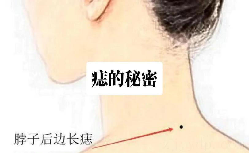 左脖子有痣富贵命,脖子上有痣代表什么