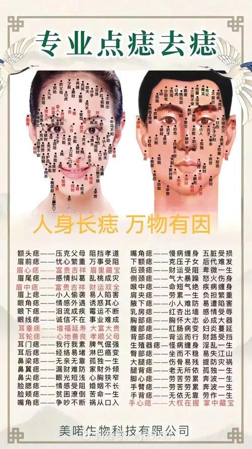 平步青云 飞黄腾达 男人身上特别旺子的痣